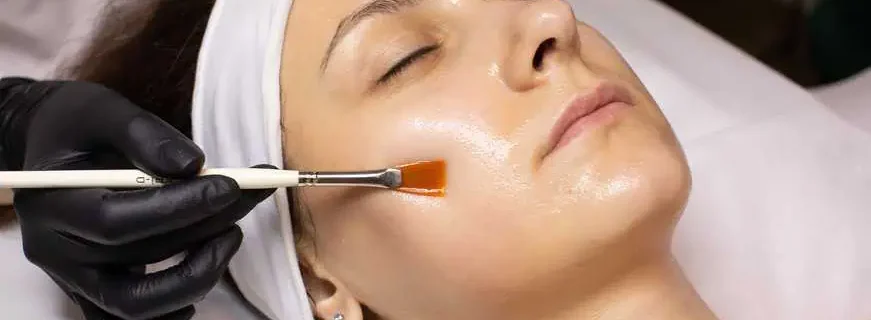 Chemical Peels by Natural Beauty Aesthetics, PLLC in Goldsboro, NC