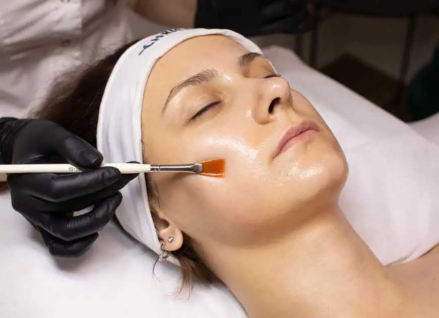 Chemical Peels by Natural Beauty Aesthetics, PLLC in Goldsboro, NC