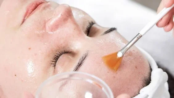 Professional Chemical Peels in Goldsboro NC